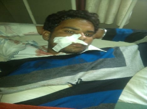 Fight in nauhjheel during election