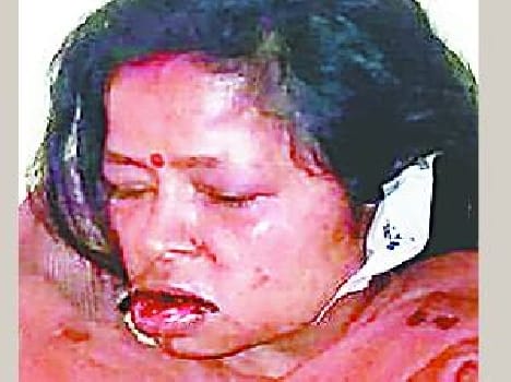 dacoits attack in naanpara