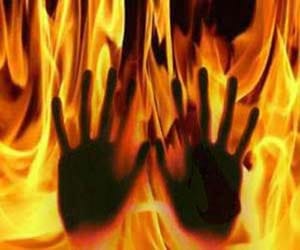 burn, stove, burst, pathankot, girl