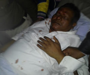 chhattisgarh home minister injured in road accident