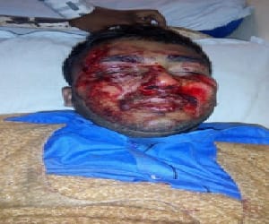 one injured in accident