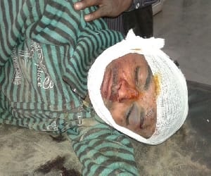 one injured in accident