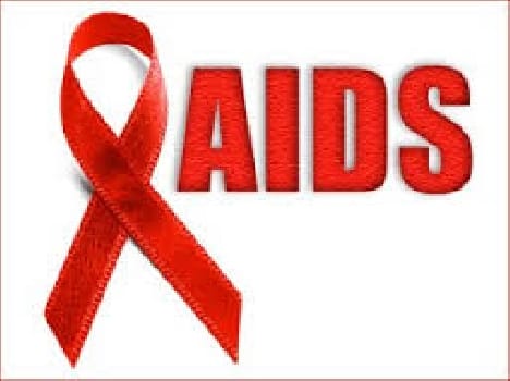 discussion on HIV test