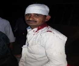 Upturned tractor trolley , injuring nine faithful