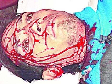 Injured in the accident, two traders