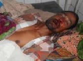 Tiger attack Farmer injured