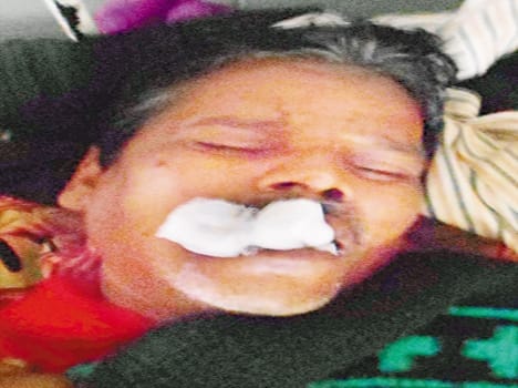 Wife teeth cut her husband's tongue