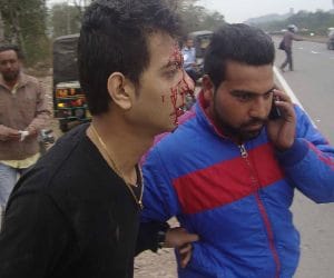 sambar killed due to hit by taxi, man injured