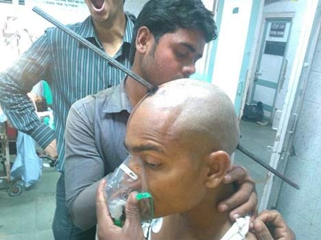 Construction worker's head is pierced by a rod