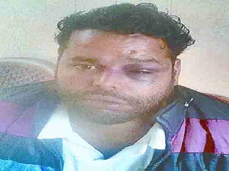 To help the wounded young man brutally beaten by police