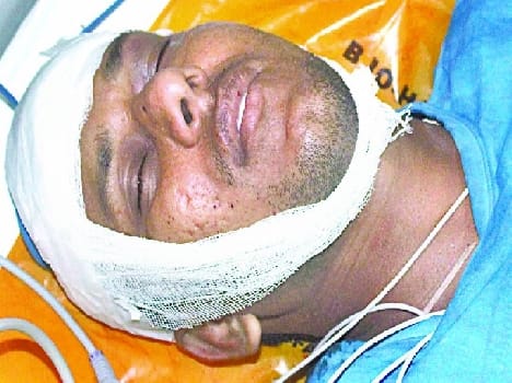 BJP leader shot in Bithricanpur