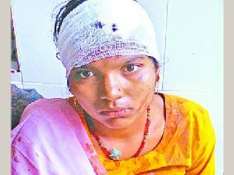 man beated mother, fired in brother