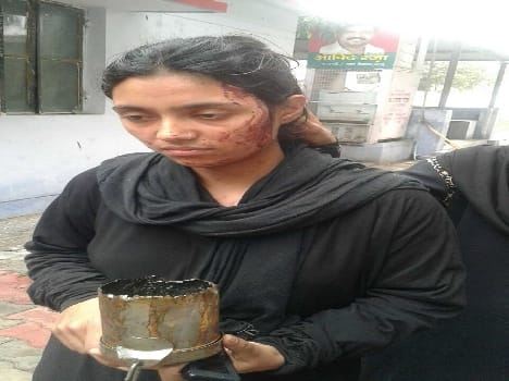 Threw acid on a girl, survived