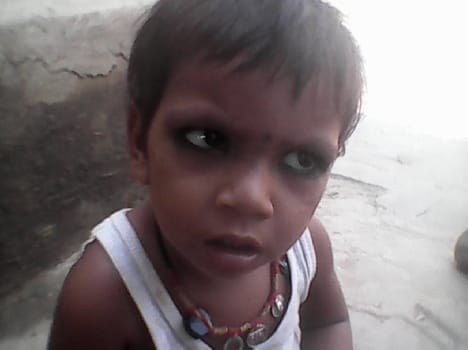 child colleps in accident
