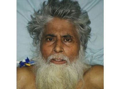 kgmu doctors saved the kidney patients life