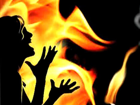 girl burnt herself being teased by local boys