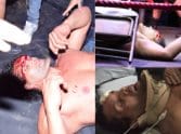 Nine injured in road accidents , 