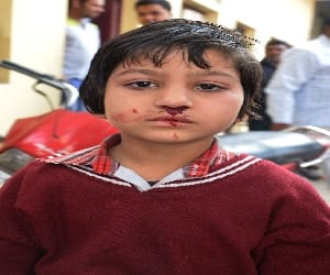 fees not deposited, girl beaten.