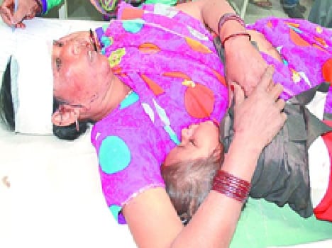 Tempo reflex, 12 injured