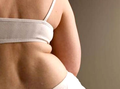 way to fix the hormones that make us fat