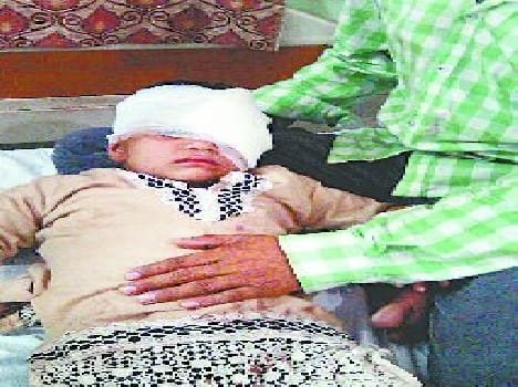 Six -year-old took the dog 's eye scrape