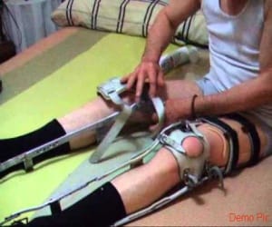 Every Monday in the district hospital will free leg braces.