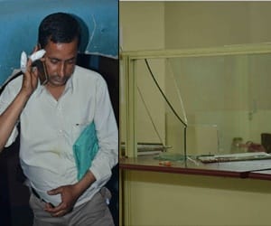 Came into the bank for robbery, cut off fingers of a man 